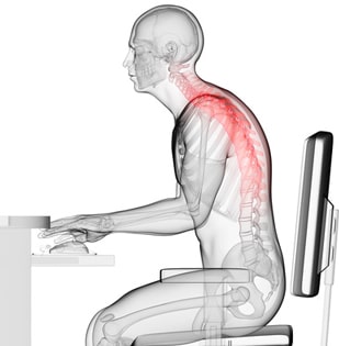 脊柱起立筋、多裂筋といった背骨回りの筋肉が緊張している図